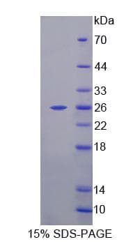 Human NT5M Protein (Recombinant)
