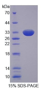 Human SLC22A11 Protein (Recombinant His, N-Terminal)