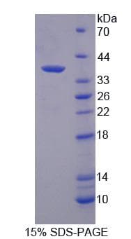 Human SF1 Protein (Recombinant His, N-Terminal)