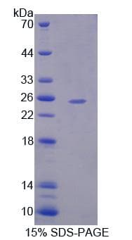 Human USP2 Protein (Recombinant His, N-Terminal)