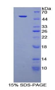 Mouse KLB / Beta Klotho Protein (Recombinant His, N-Terminal)