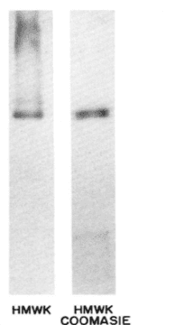 KNG1 / Kininogen / Bradykinin Antibody (clone 2B5)