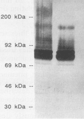 Streptococcus pneumoniae Antibody (clone XI64)