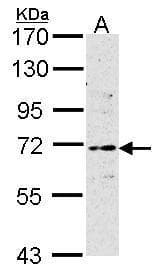 ER Alpha / Estrogen Receptor Antibody (N-Terminus)