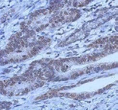 FOXO1 / FKHR Antibody (aa242-655, clone 7H3)