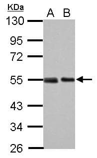 Monoclonal Mouse anti-Human TP53 / p53 Antibody (aa14-389, IHC, WB)