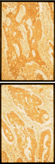FN1 / Fibronectin Antibody (clone FN12-8)