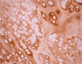 Monoclonal Mouse anti-Bovine Osteocalcin Antibody (clone OC4-30, IHC, WB)