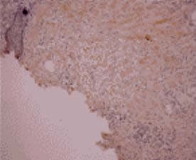 Monoclonal Mouse anti-Bovine Osteocalcin Antibody (clone OC4-30, IHC, WB)