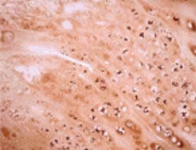 Osteocalcin Antibody (aa21-31, clone OCG2)