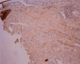 Osteocalcin Antibody (aa21-31, clone OCG2)