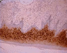 Osteocalcin Antibody (aa21-31, clone OCG2)