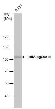 TSG101 Antibody (aa167-374, clone 1F3)