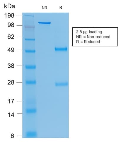 Recombinant Monoclonal Mouse anti-Human CEACAM1,5 Antibody (clone rC66/1009, IHC)