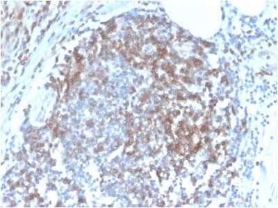 CD6 Antibody (clone C6/2884R)