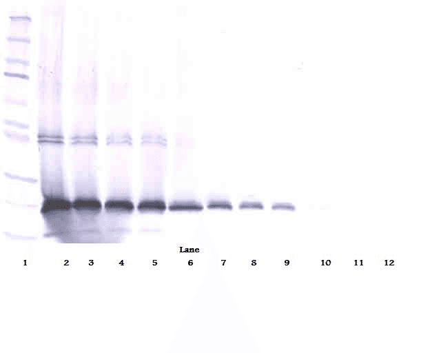 Polyclonal Rabbit anti-Human IL17D Antibody (WB)