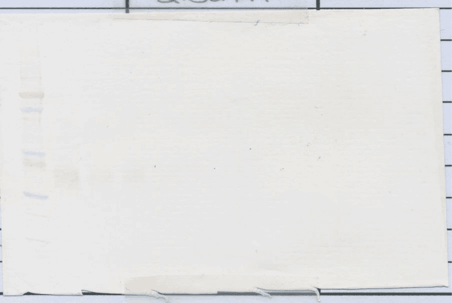 EPO / Erythropoietin Antibody