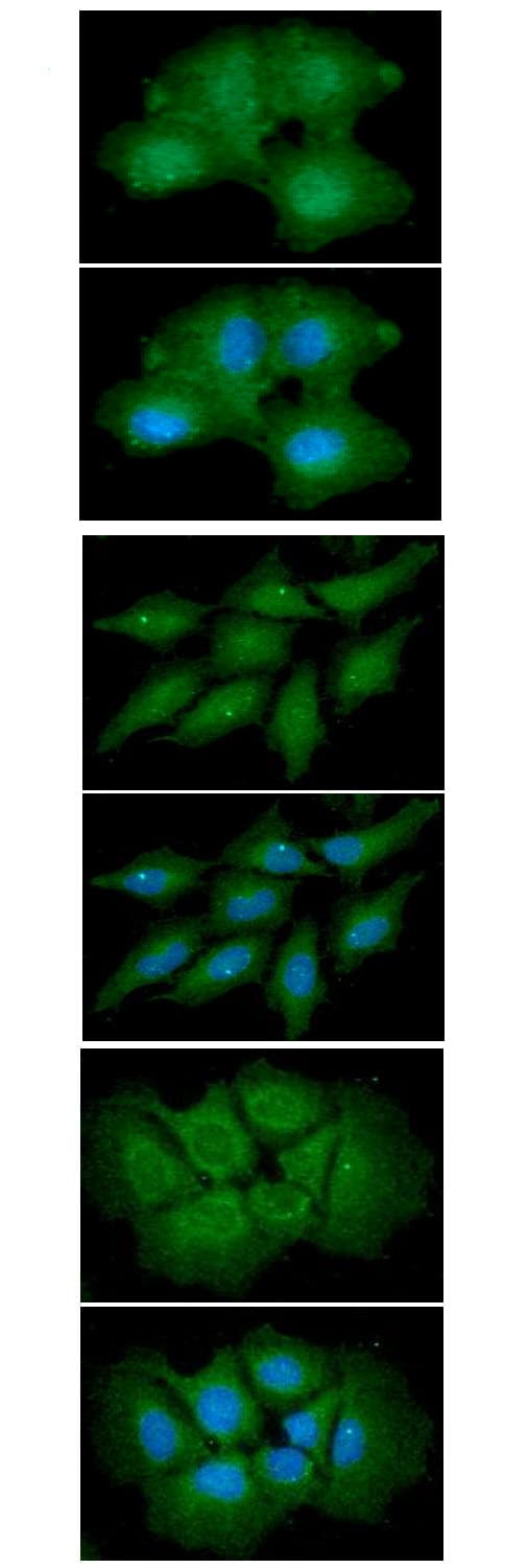 Monoclonal Mouse anti-Human IL6 / Interleukin 6 Antibody (clone AT1H6, WB)