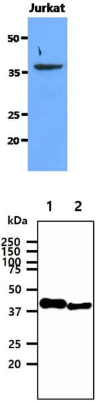 Monoclonal Mouse anti-Human SORD / Sorbitol Dehydrogenase Antibody (clone AT10F4, WB)