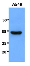 SNAI1 / SNAIL-1 Antibody (clone AT2D5)
