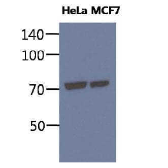 HSPA5 / GRP78 / BiP Antibody (clone AT3D2)