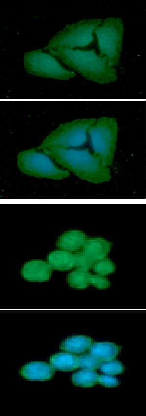 FCGR1A / CD64 Antibody (clone AT37F7)