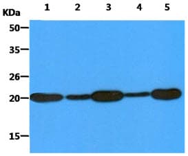 Monoclonal Mouse anti-Human PMVK Antibody (clone AT21C10, WB)