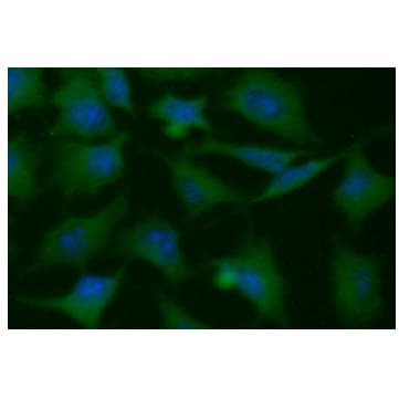Monoclonal Mouse anti-Human PGAM1 Antibody (clone AT1G4, WB)