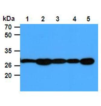 Monoclonal Mouse anti-Human PGAM1 Antibody (clone AT1G4, WB)