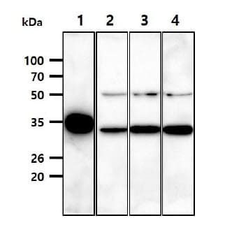 Monoclonal Mouse anti-Human LDHB / Lactate Dehydrogenase B Antibody (clone AT14D7, WB)