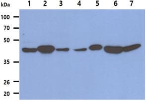 Monoclonal Mouse anti-Human FH / Fumarase / MCL Antibody (clone AT3F6, WB)