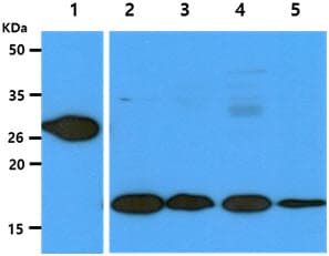 Monoclonal Mouse anti-Human GSTT1 Antibody (clone AT38D11, WB)