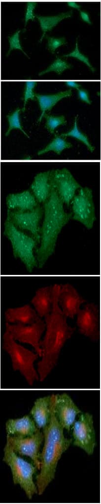 S100A4 / FSP1 Antibody (clone AT1C3)