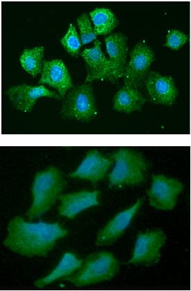 AHSA1 / AHA1 Antibody (clone AT3E9)
