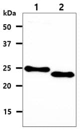 CDKN1B / p27 Kip1 Antibody (clone AT7B9)