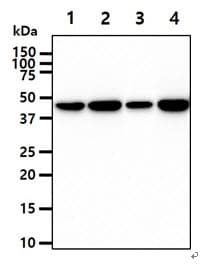 Monoclonal Mouse anti-Human CKB / Creatine Kinase BB Antibody (clone AT8E4, WB)