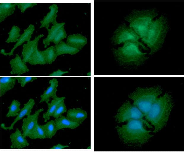 Monoclonal Mouse anti-Human PA2G4 / EBP1 Antibody (clone AT5E7, WB)