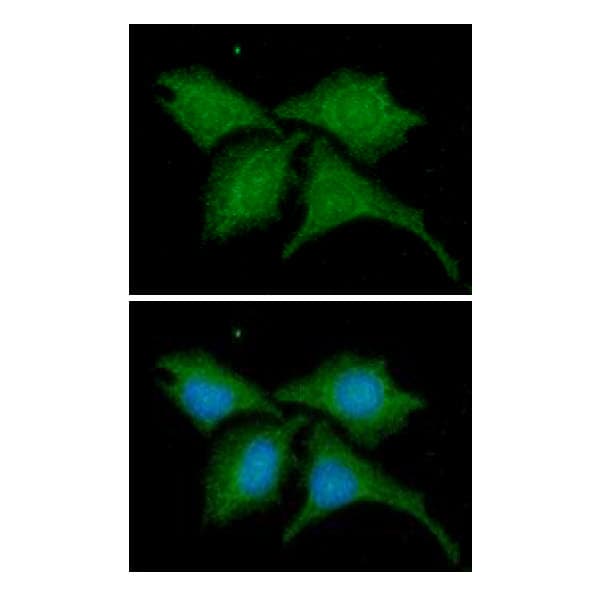 B2M / Beta 2 Microglobulin Antibody (clone AT101F10)