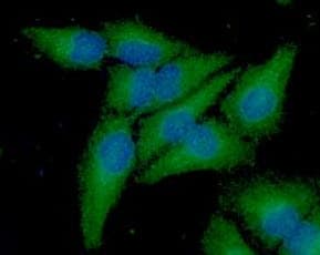 Monoclonal Mouse anti-Human FXN / Frataxin Antibody (clone AT10E11, WB)