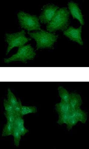 EPHA2 / EPH Receptor A2 Antibody (clone AT66G9)
