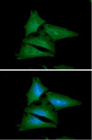 Leptin Antibody (clone AT7E10)