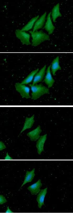 NME1 / NM23 Antibody (clone AT5F4)