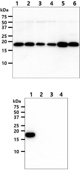 NME1 / NM23 Antibody (clone AT5F4)