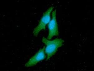 Monoclonal Mouse anti-Human c-Src Kinase / CSK Antibody (clone AT7C6, WB)