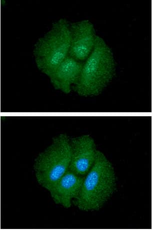 CTGF Antibody (clone AT18E7)