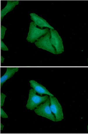 Monoclonal Mouse anti-Human FHL2 Antibody (clone AT21D11, WB)