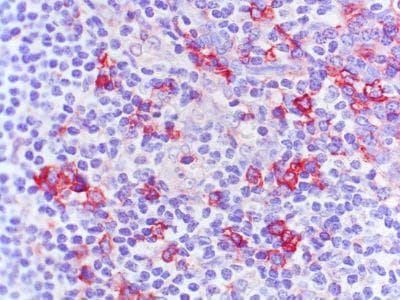 Monoclonal Mouse anti-Human CCR2 Antibody (clone 7A7, IHC)
