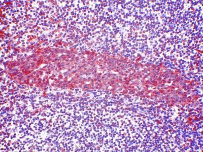 Monoclonal Mouse anti-Human CCR2 Antibody (clone 7A7, IHC)