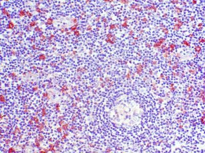 Monoclonal Mouse anti-Human CCR2 Antibody (clone 7A7, IHC)