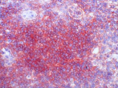 Monoclonal Mouse anti-Human CD3 Antibody (clone CRIS-7, IHC)